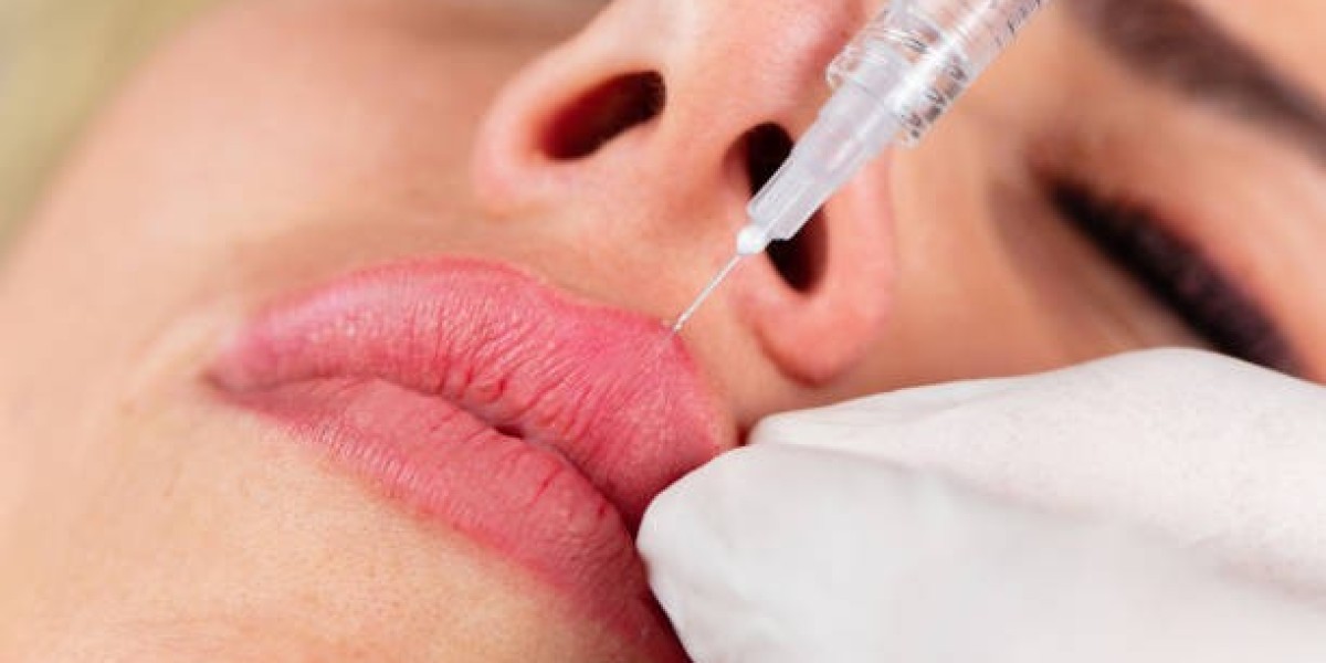 Botox Lipflip Recovery: What to Expect Post-Treatment