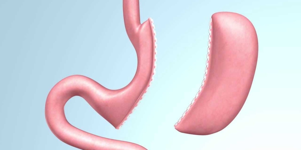 Does Gastric Sleeve Surgery Improve Heart Health?