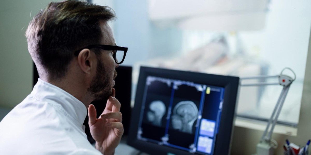 What is MRI Brain Angio and How Does it Help in Diagnosing Brain Disorders