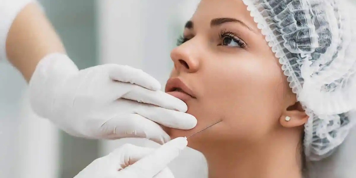 Thread Lift in Islamabad for Sagging Skin