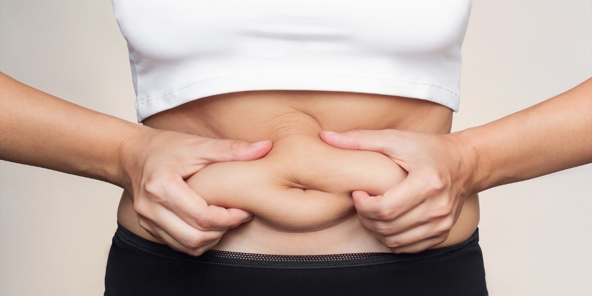 Can Tummy Tuck Surgery Address Stretch Marks on the Abdomen?