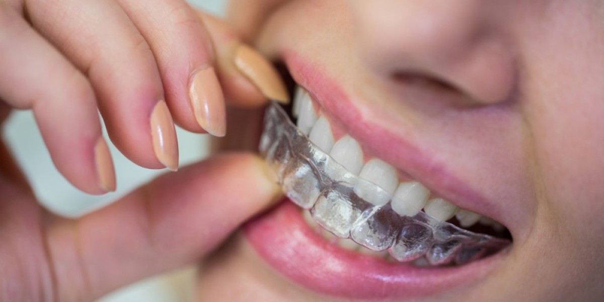 Dental Aligners: Straighten Teeth Comfortably and Invisibly Diagnopein