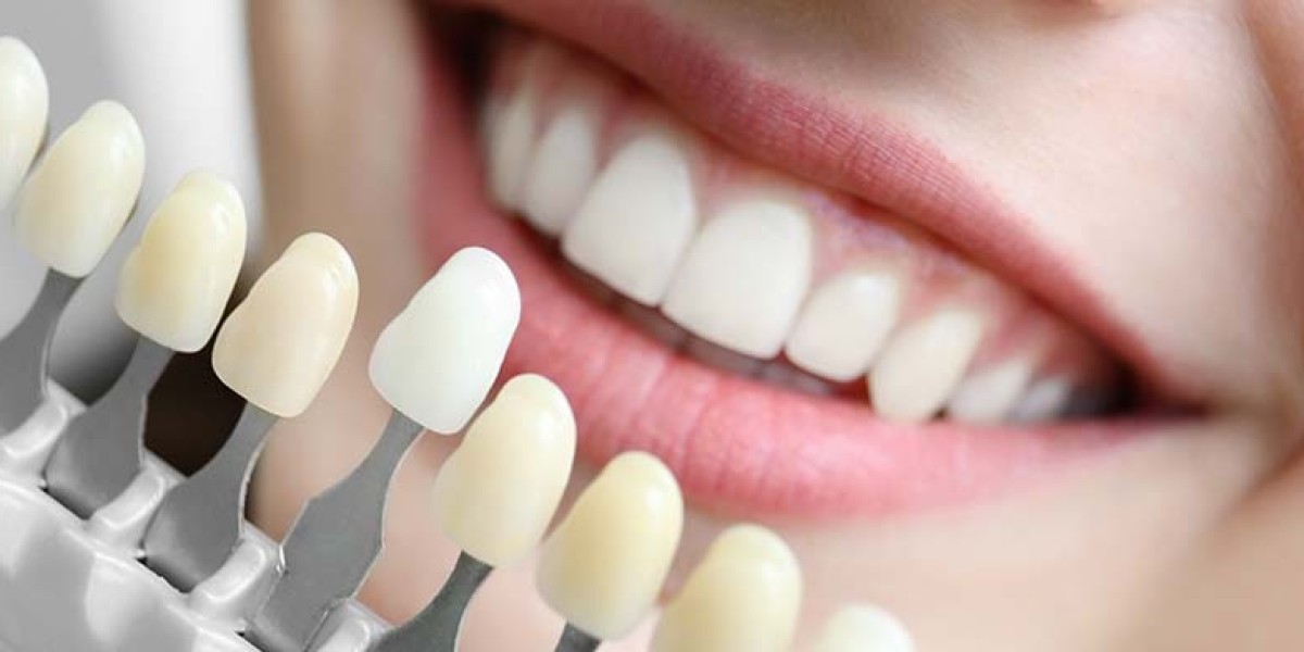Cosmetic Dentistry for Gaps, Chips, and Crooked Teeth
