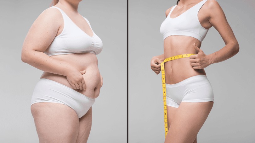 Weight Loss Clinic