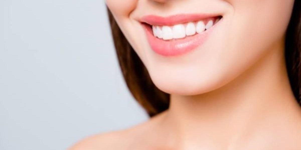 Step-by-Step Guide to Professional Teeth Whitening Treatment