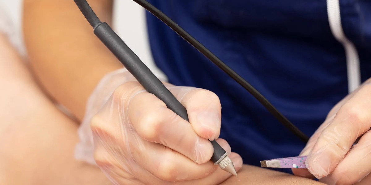 What Is Electrolysis Hair Removal and How It Works?