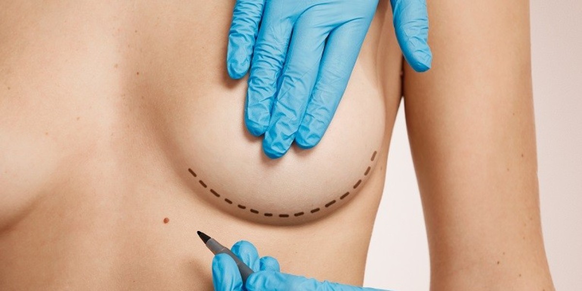 Breast Reduction Surgery in Riyadh: How to Choose Between Implants or Reduction