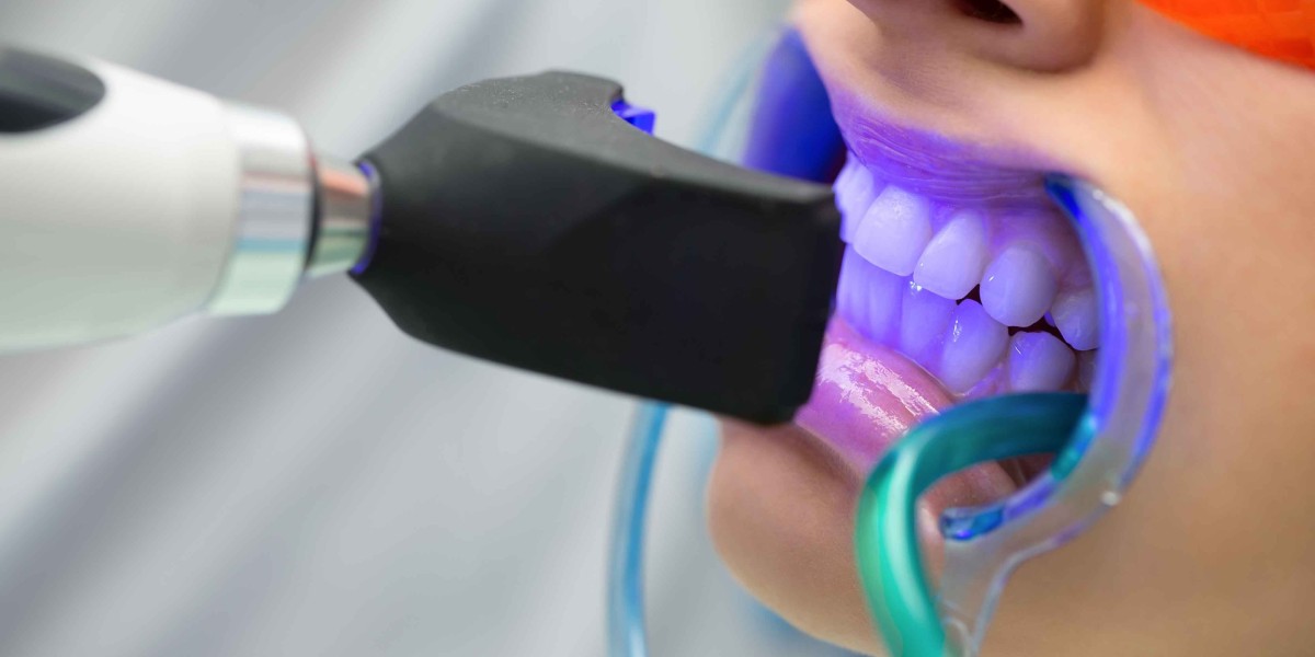 Teeth Whitening vs. Cleaning – Understanding the Difference
