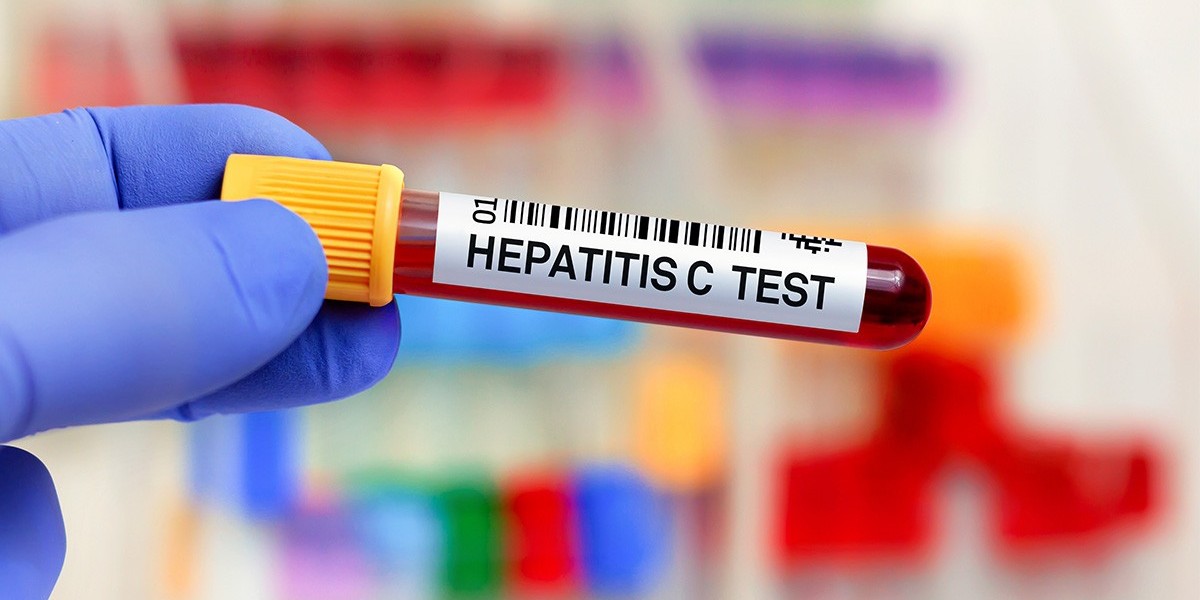 Can Hepatitis C Be Found With One Test?