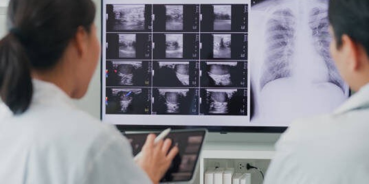 X-ray Machine for Buy – Reliable Imaging Systems for Clinics and Hospitals