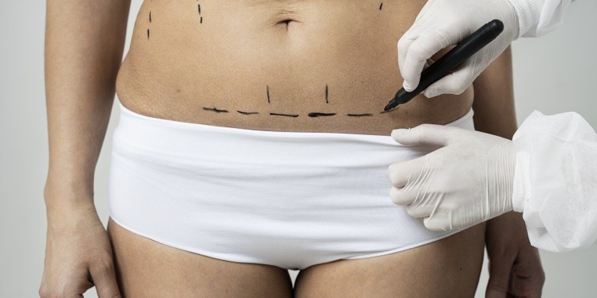 How Effective Is Laser Liposuction in Riyadh for Cellulite Reduction?