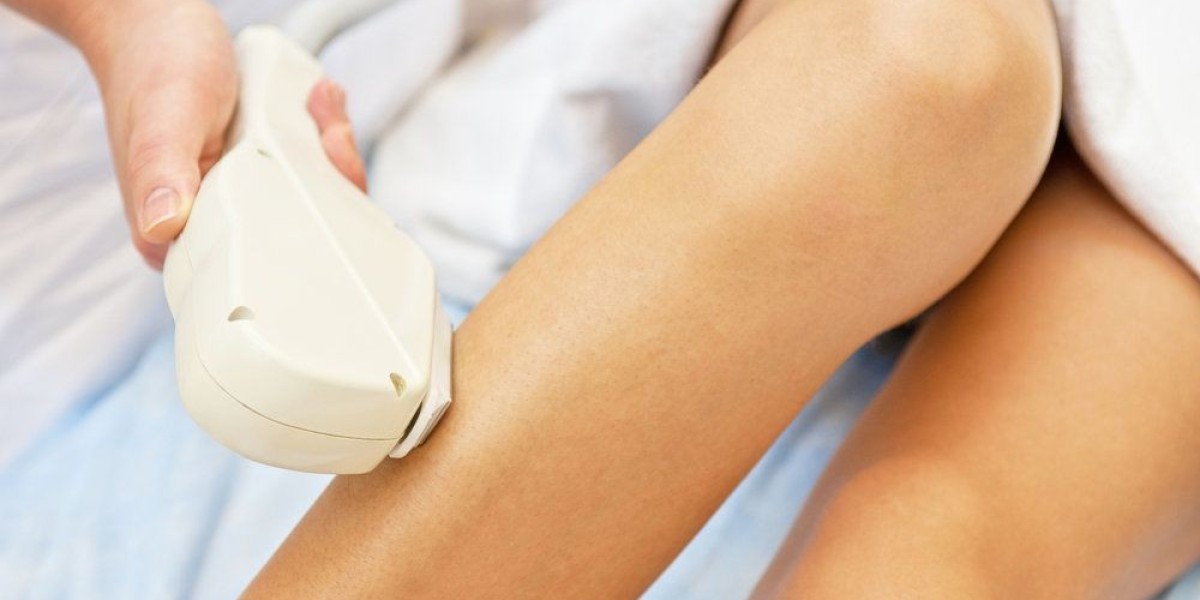 Can Laser Hair Removal Treat Facial Hair Safely?