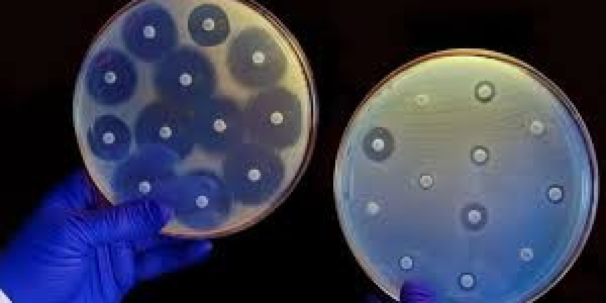 Antimicrobial Susceptibility Test Market research emphasizing cost-effectiveness of automated and manual testing solutio