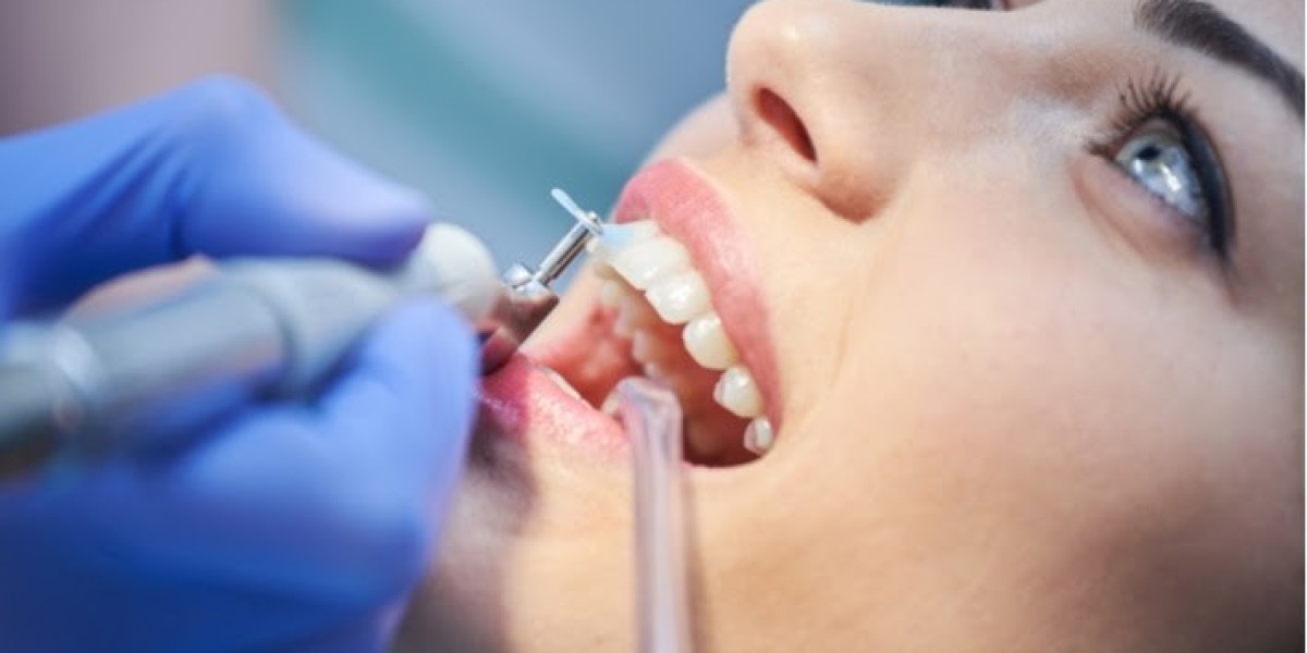 Teeth Cleaning for Seniors: Essential Tips for Lasting Oral Care