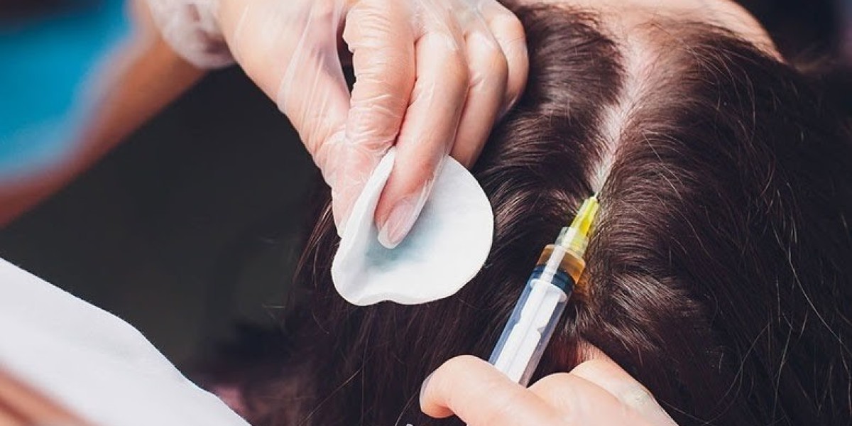 Does Stem Cell Hair Transplant Work Effectively for Women?