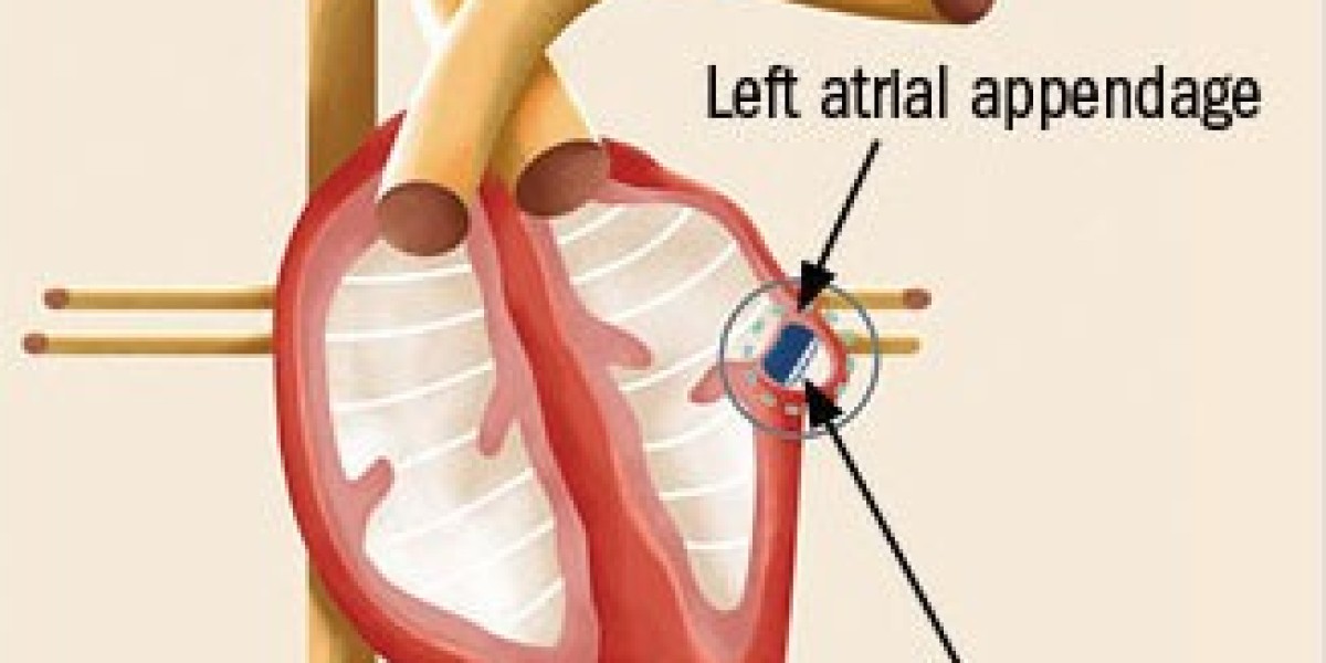 Atrial Fibrillation Device Market: Regulatory Updates and Global Expansion
