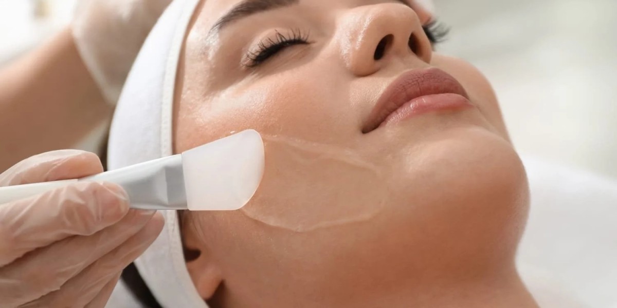 Can Radiance Peel Treatments Minimize Fine Lines?