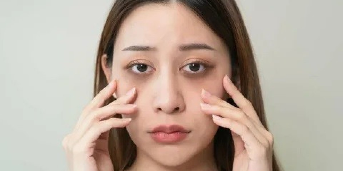 Laser Dark Circles Treatment in Islamabad