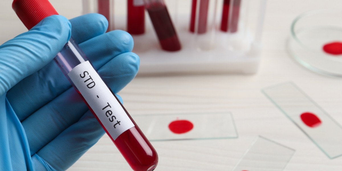 STD Test in Dubai: The Importance of Early Detection and Treatment