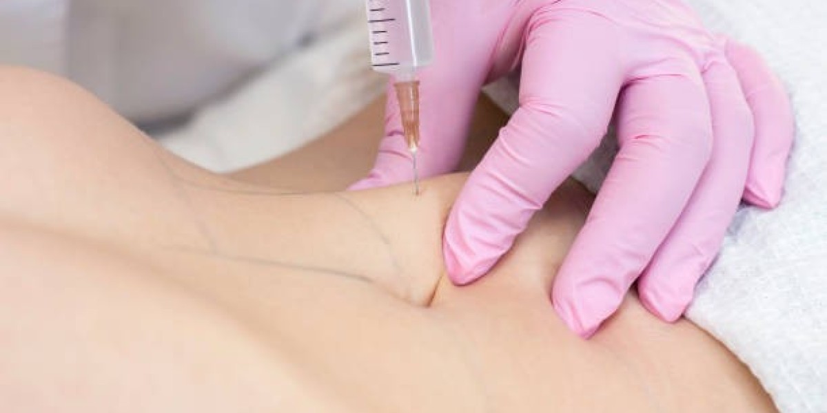 Fat Melting Injection Dubai: Non-Invasive Alternatives to Surgery