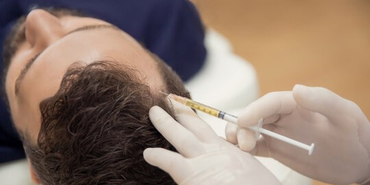 Benefits of PRP Treatment for Skin and Hair in Islamabad
