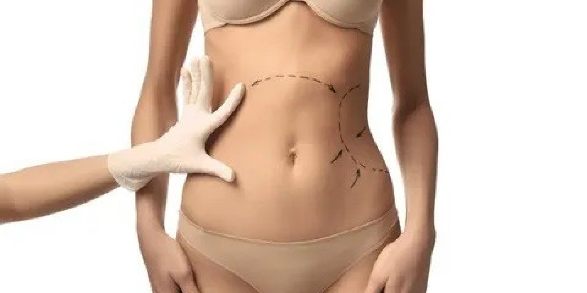 Body Contouring in Islamabad: Ideal Candidates