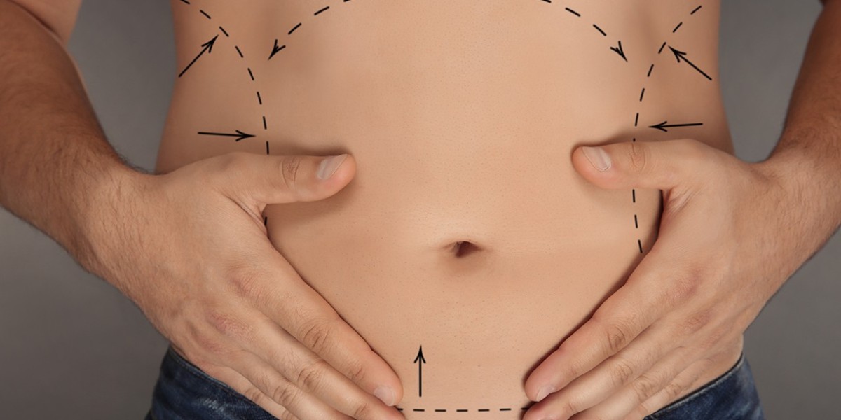 What Are the Long-Term Benefits of a Tummy Tuck Surgery?