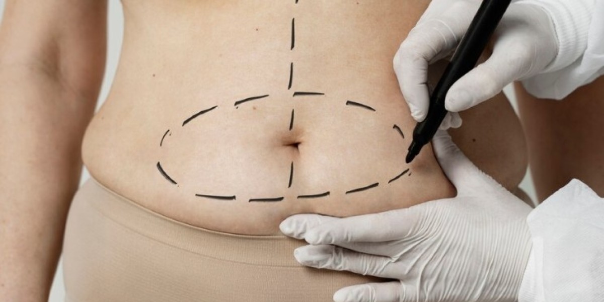 Liposuction Surgery in Dubai vs. Tummy Tuck: Which One Do You Need?