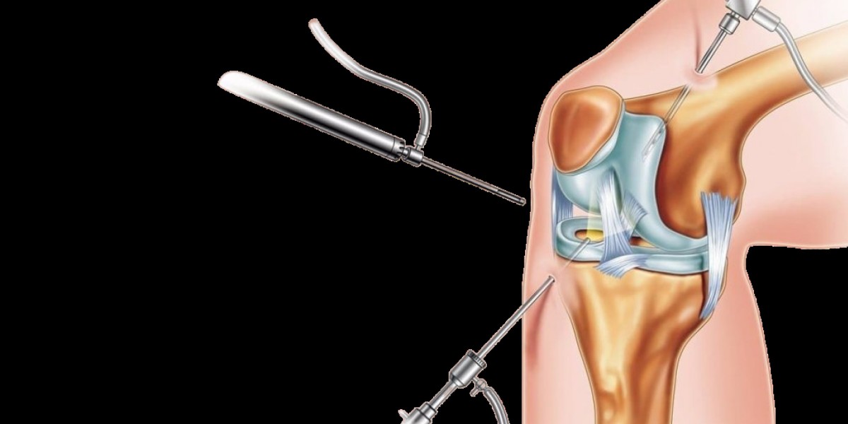 Arthroscopy Devices Market Emerging Trends Highlighting Technological Innovation, Minimally Invasive Surgery, and Smart 