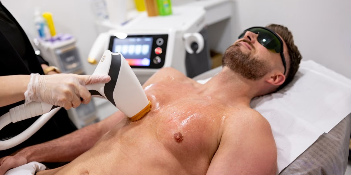 How High Is Male Laser Hair Removal Cost?
