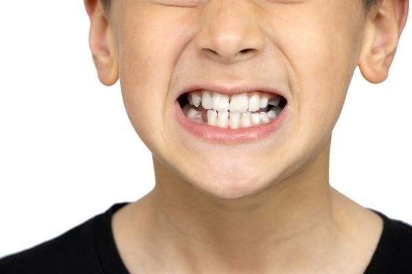 orthodontist Newquay