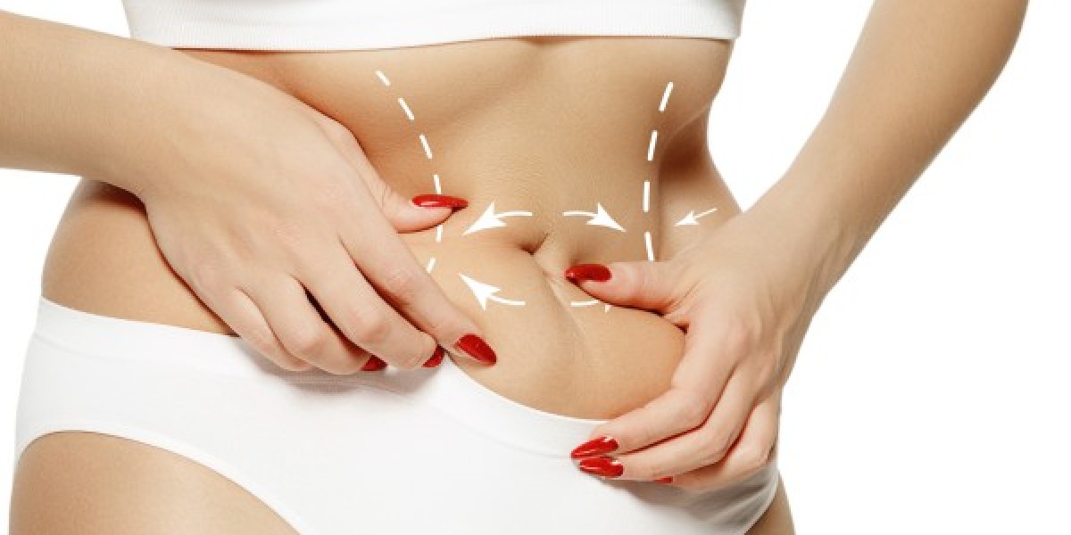 Is Tummy Tuck Surgery Suitable for Older Patients?