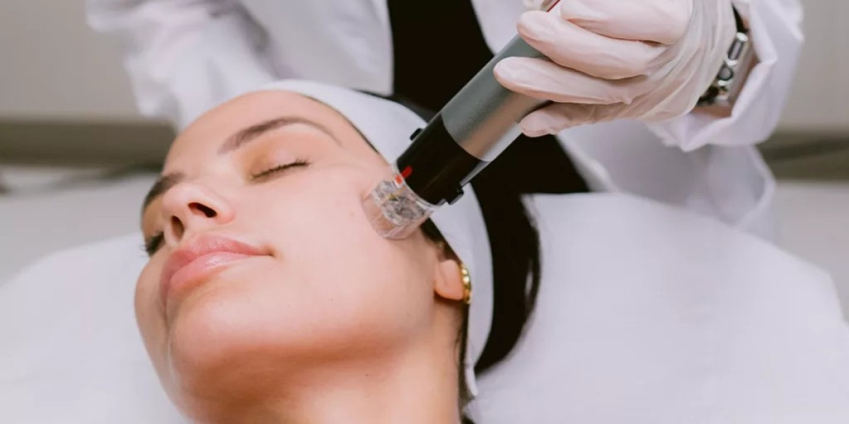 Can Fractional RF Microneedling in Dubai reduce acne scars fast?