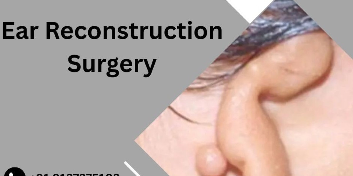 FAQs on Microtia Ear Cartilage Surgery Answered