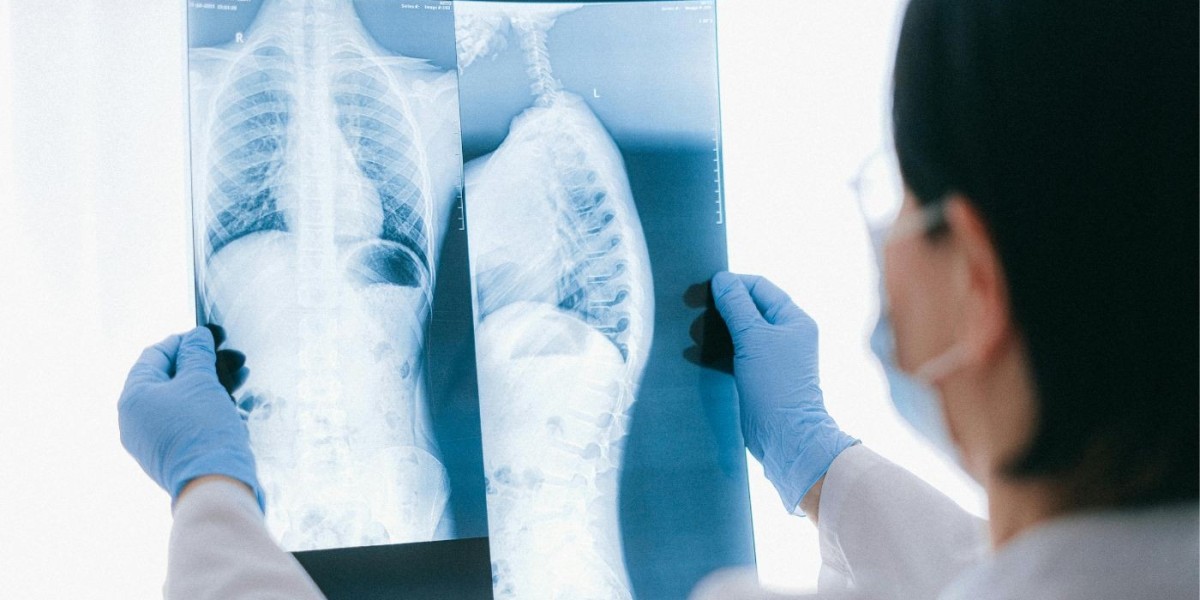 When Do You Need an MRI LS Spine WSS? | Diagnopein Diagnostic