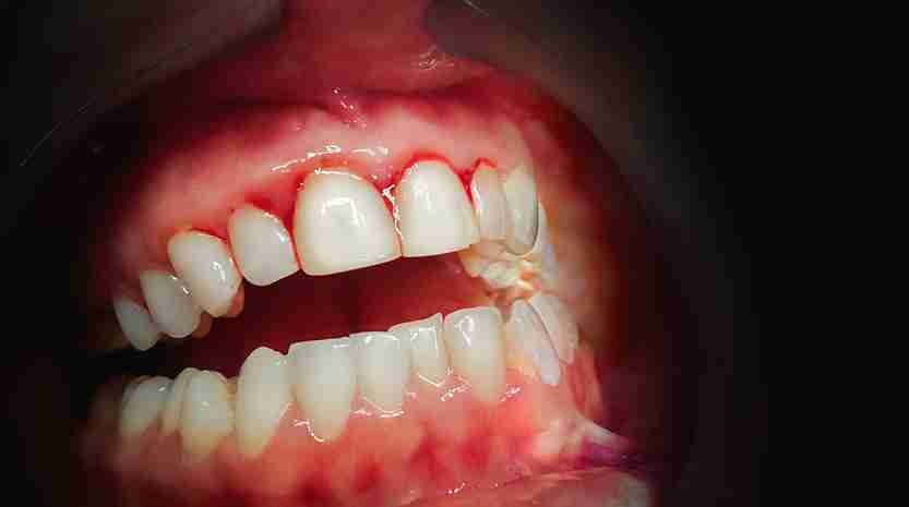 emergency dentist in Havant