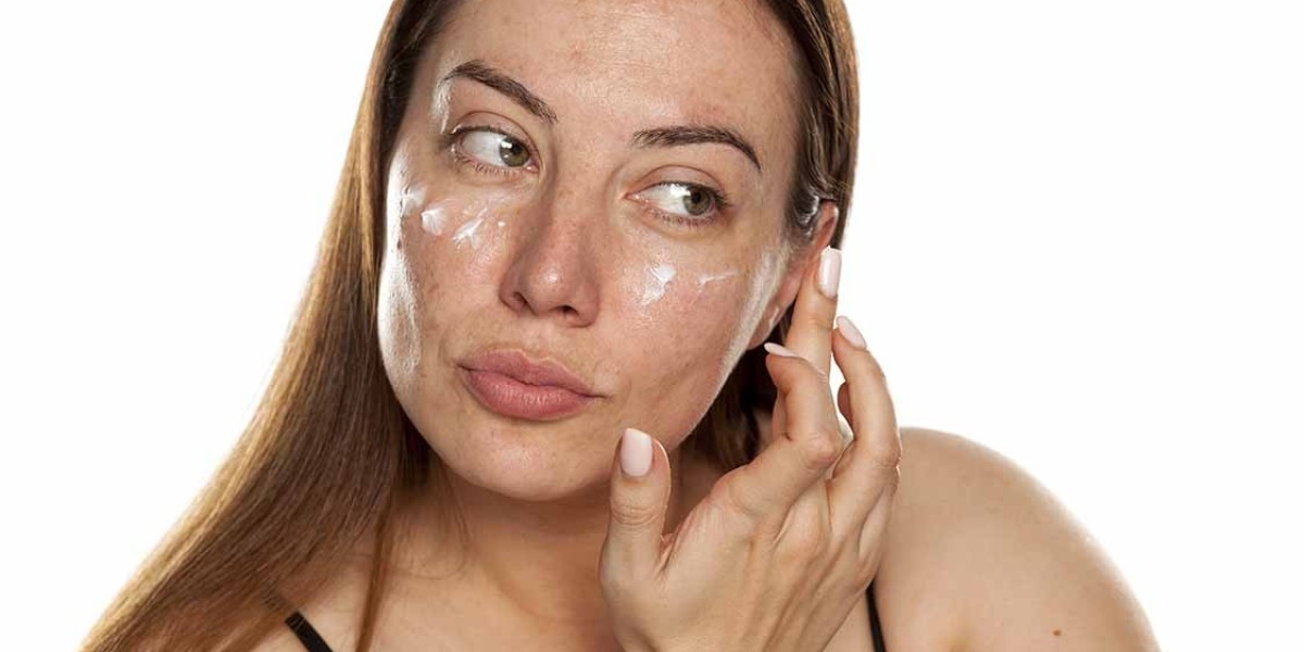 How Medixo Aesthetic Clinic in Islamabad, Rawalpindi & Pakistan Clears Melasma Marks?