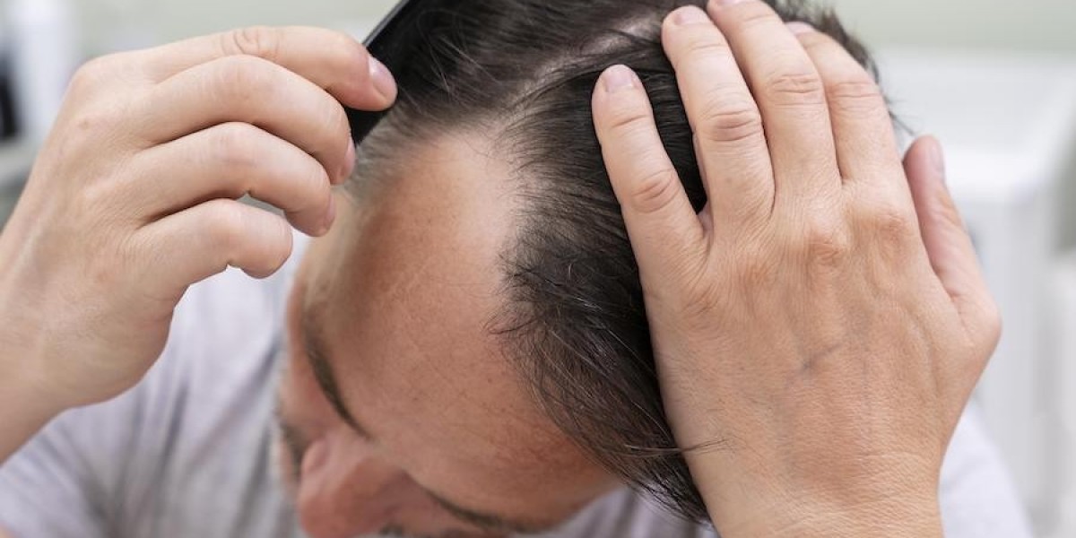 Can Hair Loss Treatments Quickly Increase Hair Thickness?