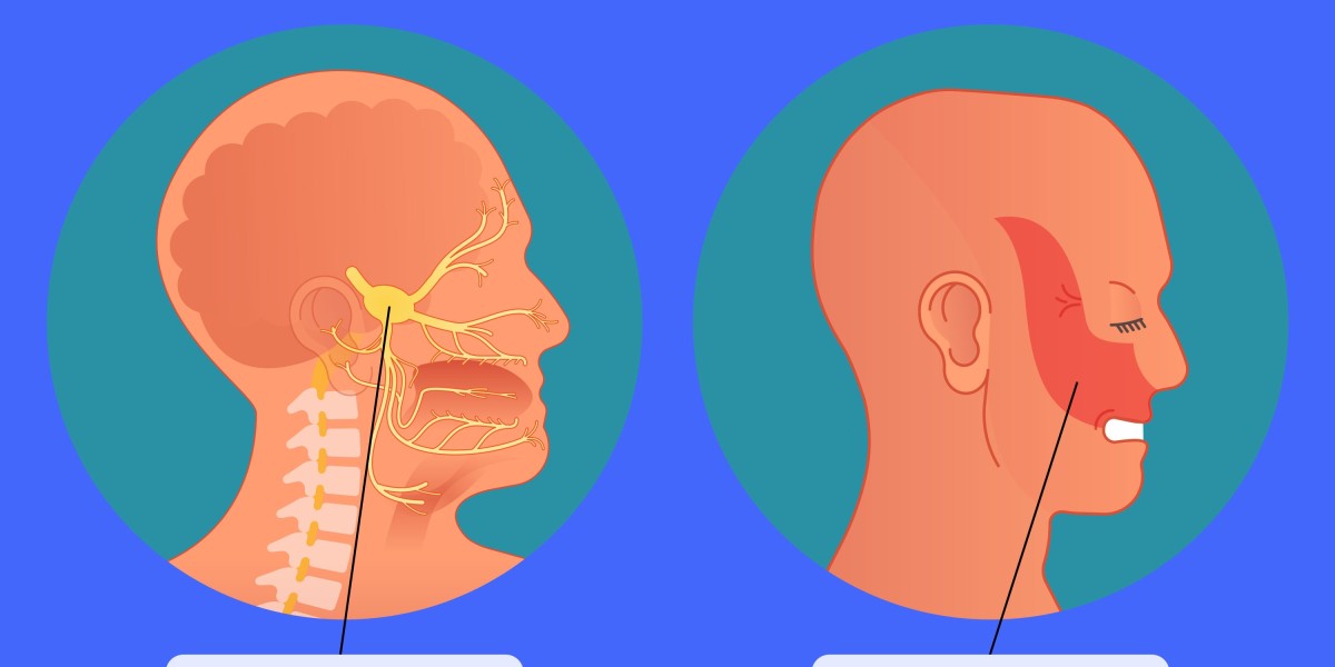 Living with Trigeminal Neuralgia: Symptoms, Causes, and Real Treatments That Help