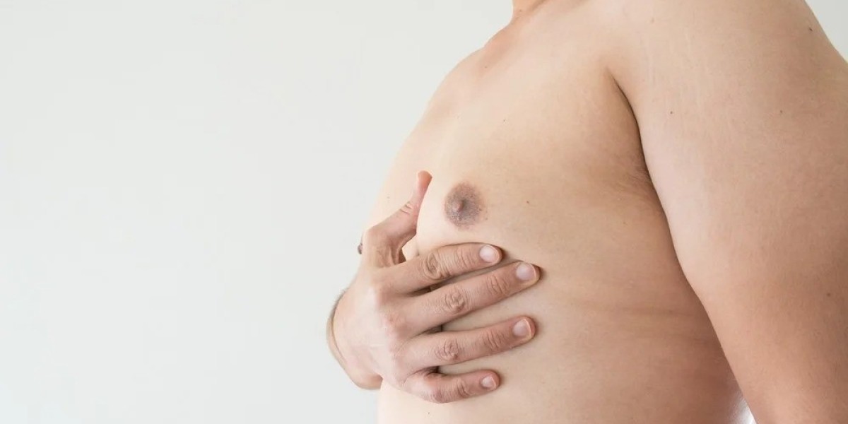 How Do Doctors Treat Gynecomastia in Dubai?