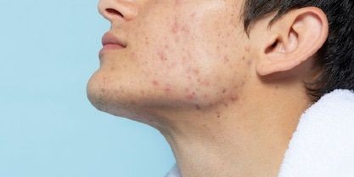 Best Practices for Skin Health as Recommended by the Best Dermatologist in Riyadh