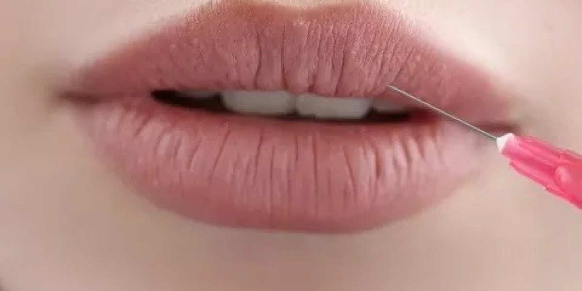 Long-Lasting Results of Lip Filler in Islamabad