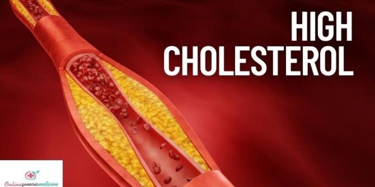 The Truth About High Cholesterol: From Pills to Lifestyle Changes