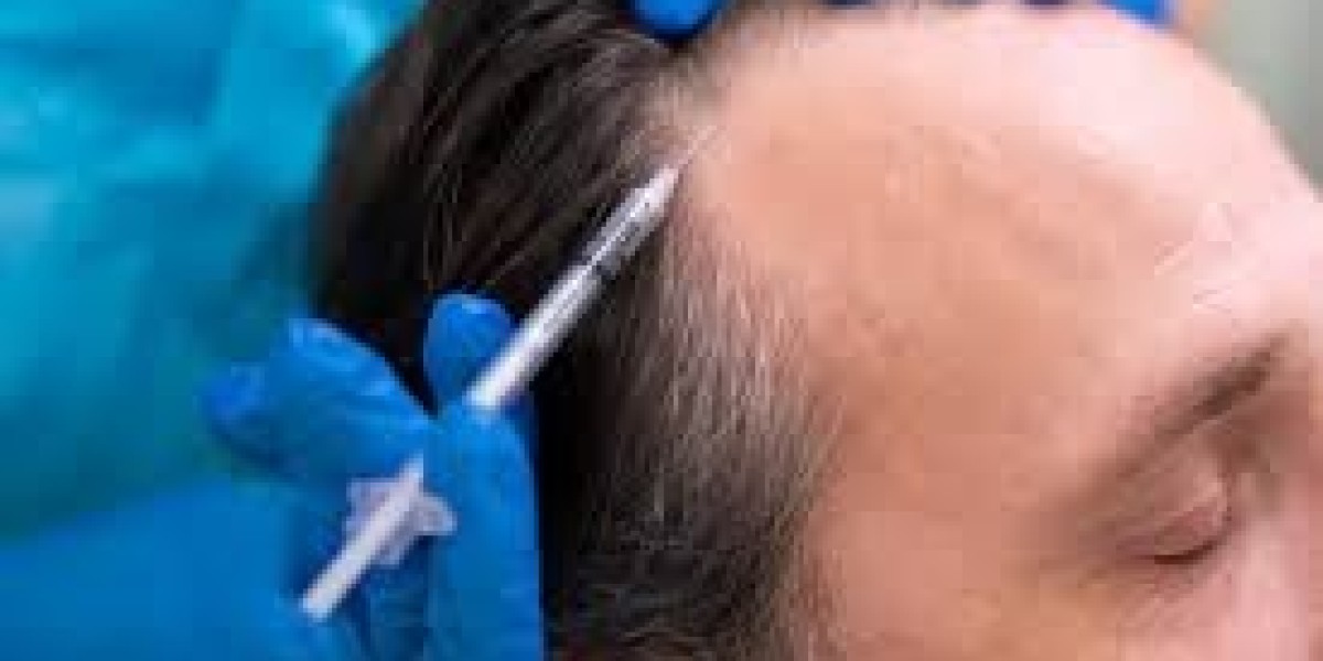 PRP for Hair in Dubai: Pain vs. Benefit in Dubai UAE At Glamorous Clinic?