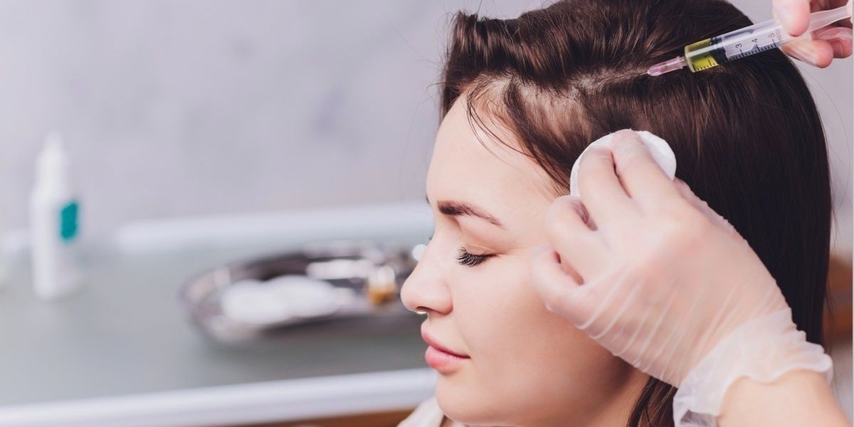 Quick Guide to PRP Hair Treatment Riyadh