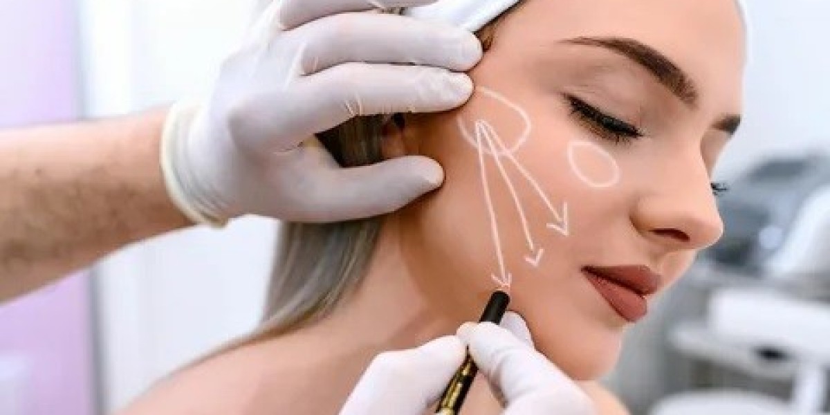 Facial Slimming Benefits of Buccal Fat Removal in Islamabad