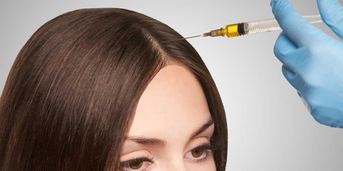 Is the Best PRP Hair Treatment in Dubai Painful?
