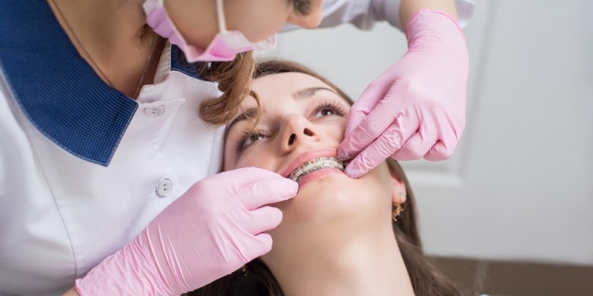 Metal Braces for Teens Why They Are Still a Popular Choice
