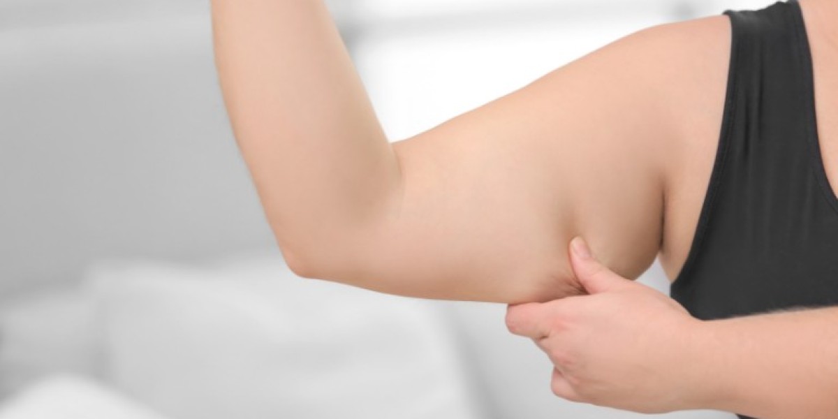 Can Laser Fat Reduction Treat Fat on the Arms?