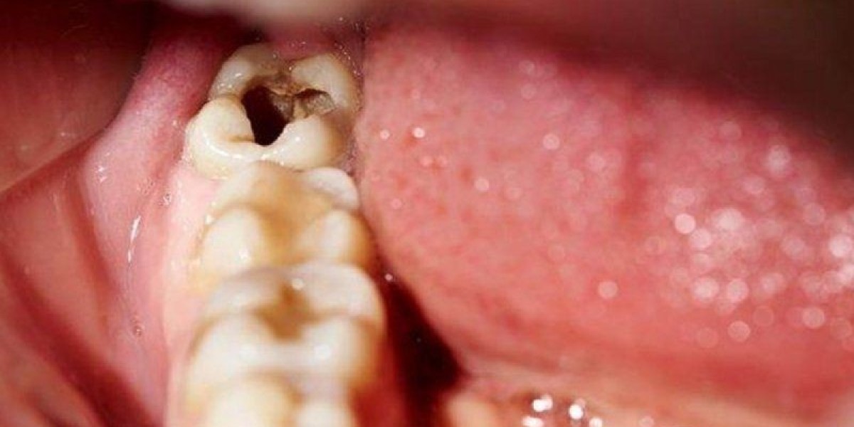 Nha khoa tốt nhất tại Việt Nam – Bí quyết chọn đúng địa chỉ cho sức khỏe răng miệng